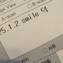 신세계안과 광주 스마일라식 후기