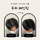 수원 근처 두피페인팅 30~40대 남성분들, 이제 탈모 스트레스 그만! 자연스럽게 채워드릴게요