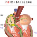 심장 부정맥 원인 검사 부정맥초기 이미지