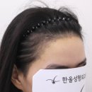 더헤어라인성형외과의원 이미지
