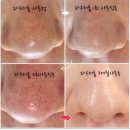 유미 인셀덤 네이버블로그