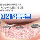 정릉치과의원 이미지