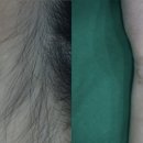 지움의원 이미지