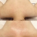 산본역 동부사거리(우리은행 쪽) | 산본역 바디 전신관리ㅣ알포유 군포점ㅣ생체전류 림프순환 테라피