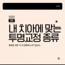 클리어(clear) 치과기공소 | 철사 교정은 부담스럽고... 내 치아에 맞는 투명교정 종류 알아볼까요?
