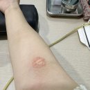 미앤맘산부인과의원 | 임신기록/ 28주 1차검사결과지들고 동네병원에서 임당재검