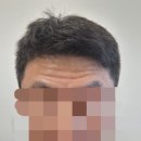 범어역 2번 출구 뒤 | 대구 범어역 인근 보톡스/에이리브의원 방문 후기 내돈내산^^