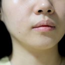 테라톡스 이미지