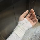 365하하병원 | 천안 화상치료 화상전문병원 치료 후기