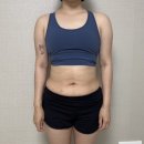 건강한뇌신경과의원 | 날씬한 상상은 이제 그만… mpl 지방분해주사 팔뚝, 허벅지 신사의원 1회차 후기