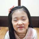 알로걸