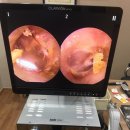 오티콘보청기 신촌센터 해피히어링 이미지