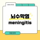 RR-60[해맞이로]-상-22 | 아동간호학)뇌수막염,뇌수막염케이스,케이스스터디,뇌수막염간호,간호과정,간호진단,간호케이스...