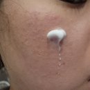 간절기 필수! 저자극 장벽크림 &#34;메디폴미 레드제로 바이옴 리페어크림&#34;