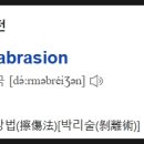 피부 찰상법, 박피술 dermabrasion 가능 병원 (청담이엘피부과 CU클린업피부과 서정피부과 아름다운나라)