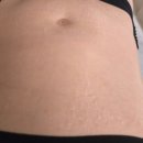 시기핏 인계점 | 수원다이어트 수원체형관리 에소코핏 인계점 누워서 쉽게 살뺄수 있는곳