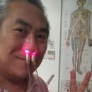 정(正)메디칼 | 모델라쥬 비염레이져치료 후기