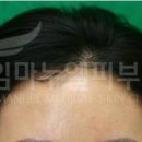 임마누엘헤어 네이버블로그