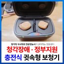 개봉동 보청기｜청각장애 보장구 최신 제품, 벨톤 귓속형 충전식 착용 후기