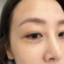 예그리나 스킨케어 | 관저동 피부관리 메디유스킨 방문 후기🌿