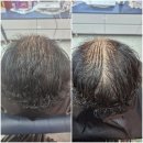 안골2길 9-7 | 전주탈모케어 두피 건강을 찾을때는 큐사랑 안골점으로