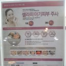 부산물광주사 시술후기에요.