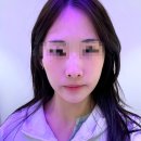 아 건 | 중안부 긴얼굴 고민이라 근육 리프팅 받아본 청담 리프팅 엠페이스 후기