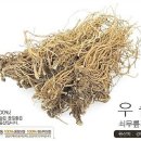 무릎 이상과 관절염에 이미지