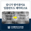평동치과의원 네이버블로그