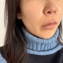 웨이브 | 땅콩형얼굴 신촌피부과 옆볼패임 개선 힐로웨이브 후기