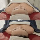 포항 흥해 초곡 피부관리 더예쁨에스테틱 바디관리 후기