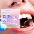 스타치과 교정과 치과의원 네이버블로그