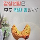 갑상선암 종류별 생존률 이미지