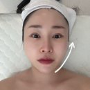 진테라피에스테틱 | 익산신동웨딩관리!안아픈 3V윤곽테라피 정든 에스테틱 후기!
