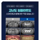 목포스마트원치과병원 이미지
