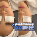둔산동 피부관리 쥬쥬뷰티크 속건조 맞춤 관리 후기
