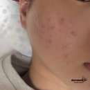 씨유천안주공5단지점 | 천안 피부관리 오마주21 스킨케어 두정동 여드름 관리 에스테틱