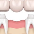 탑티어치과의원 이미지