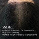 헤어팡팡 이미지