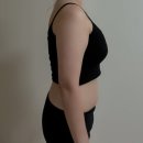 하버드센타 | 대구 예비신부다이어트 다이어트병원 지방분해주사 내돈내산 리얼후기