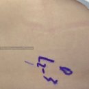 괴산군 교통약자 이동지원센터(모범운전자회) | 수원 윌스병원 내시경디스크절제술 후기(2) | 입원, 수술, 퇴원까지 (입원병동의 모든 것)