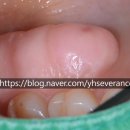 연희세브란스치과의원 이미지