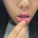 구내염과 함께한 제주 여행 후기 ('26.06.26~28) (1)