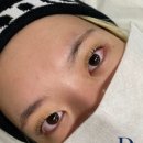 브로우돌 이미지