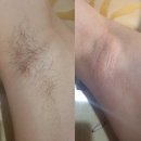 아리따운피부 이미지