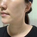 메디엠 | 보습크림, 대용량수분크림 '닥터메디엠 페이셜 레미디 크림' 후기