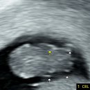 오해일여성의원 이미지