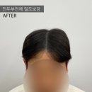 레이븐스칼프 이미지