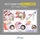 연세견우정형외과의원 네이버블로그