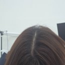 더 봄 | [정수리 탈모] 탈모병원 대신 가본 프롬더봄- 찐만족후기